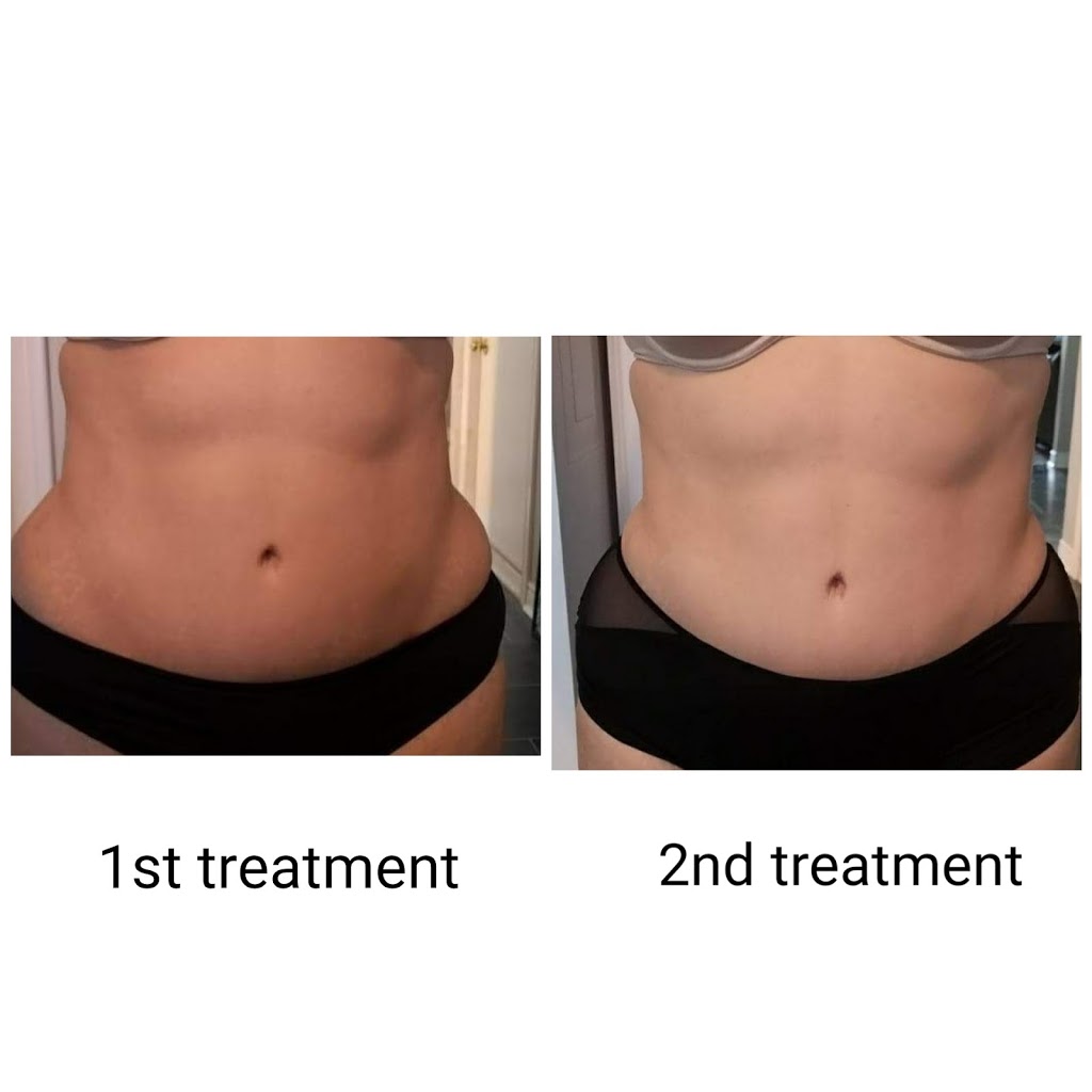 The New You Beauty Studio | 120 Glenroy Crescent, London, ON N5Z 4H7, Canada | Phone: (519) 630-5544