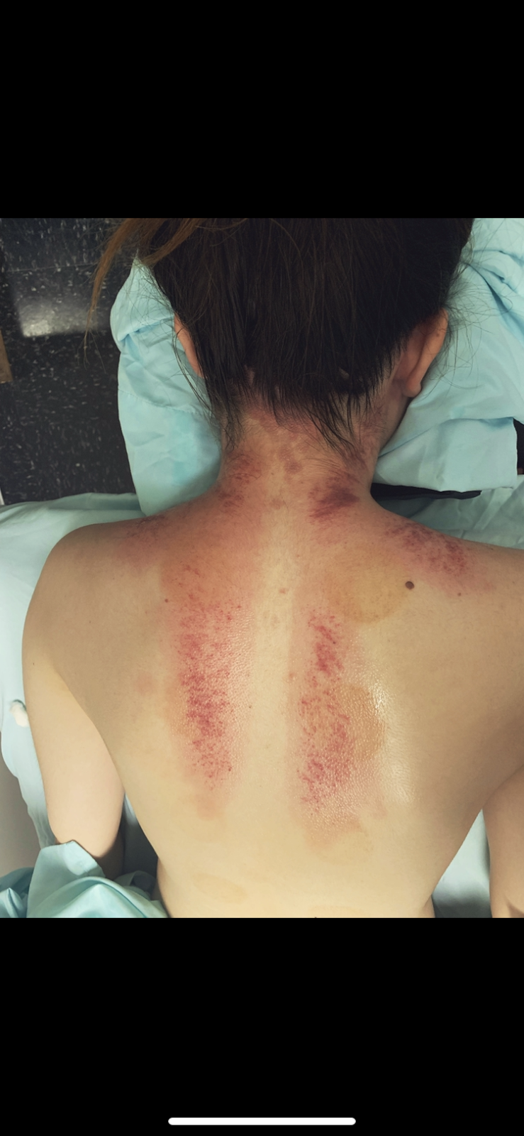Iron Compass Acupuncture | 12328 102 Ave, Edmonton, AB T5N 0L9, Canada | Phone: (780) 898-0336