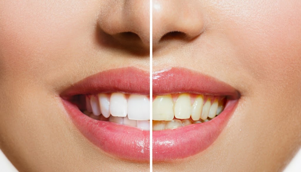 Kirollos Dental Hygiene Clinic | 2465 Walkers Line, Burlington, ON L7M 4K4, Canada | Phone: (647) 336-4133