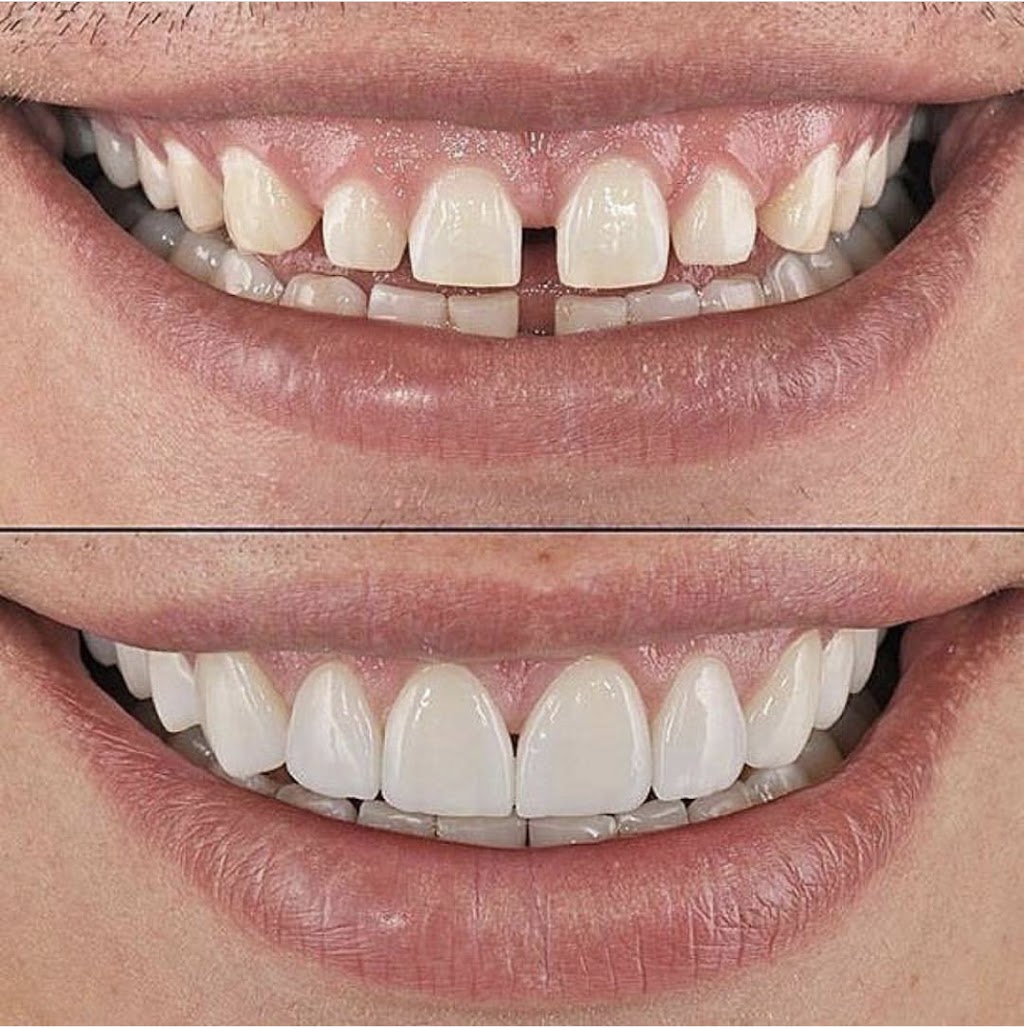 Dentistry At Bayview Glen | 8750 Bayview Ave Unit 3, Richmond Hill, ON L4B 4V9, Canada | Phone: (905) 882-0082