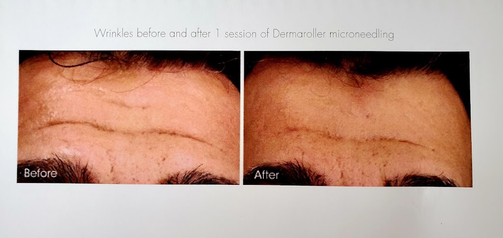 Fresh Faced Medical Aesthetics | 179 Sunlake Way SE, Calgary, AB T2X 3H4, Canada | Phone: (403) 714-8771