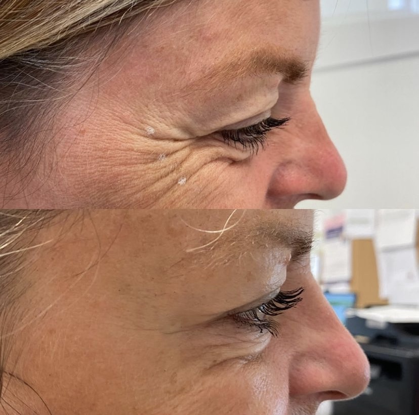 Arianne’s Aesthetics | 467 10th St, Hanover, ON N4N 1R3, Canada | Phone: (613) 328-1049
