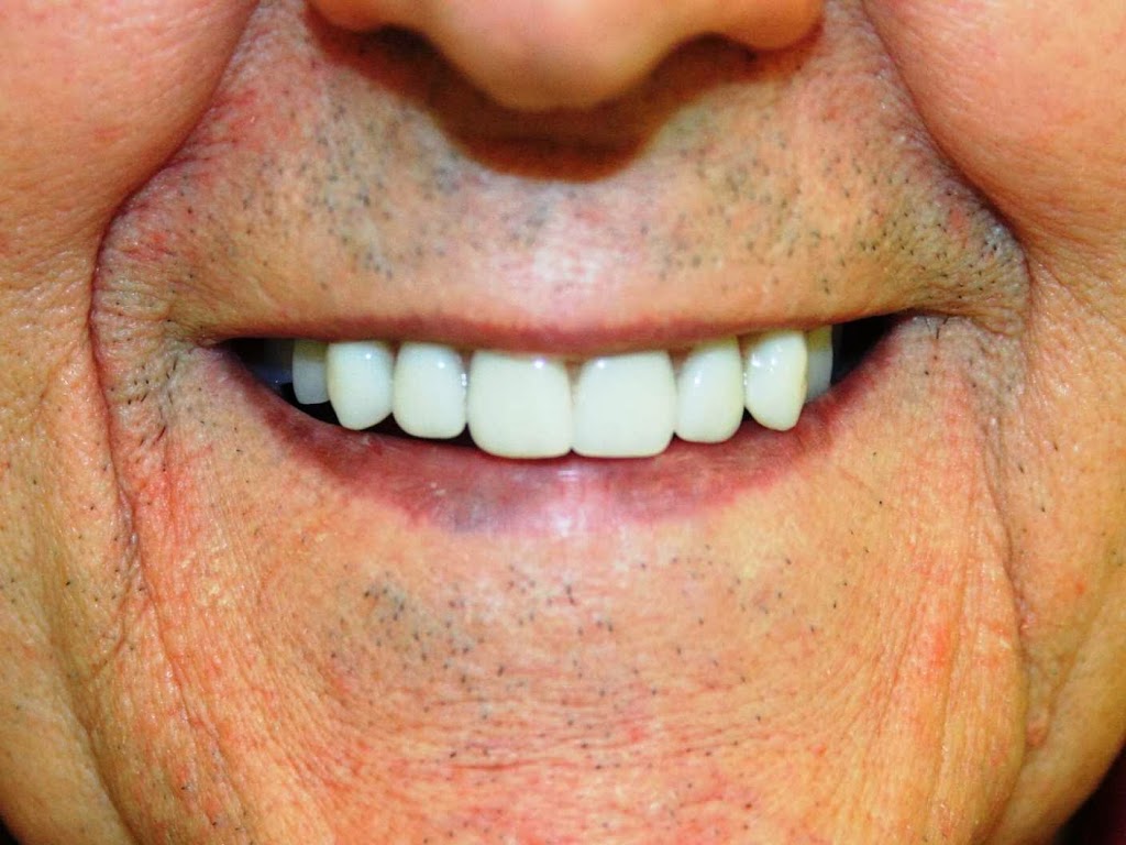 Applewood Village Dentistry | 10-1077 N Service Rd, Mississauga, ON L4Y 1A6, Canada | Phone: (905) 279-1818