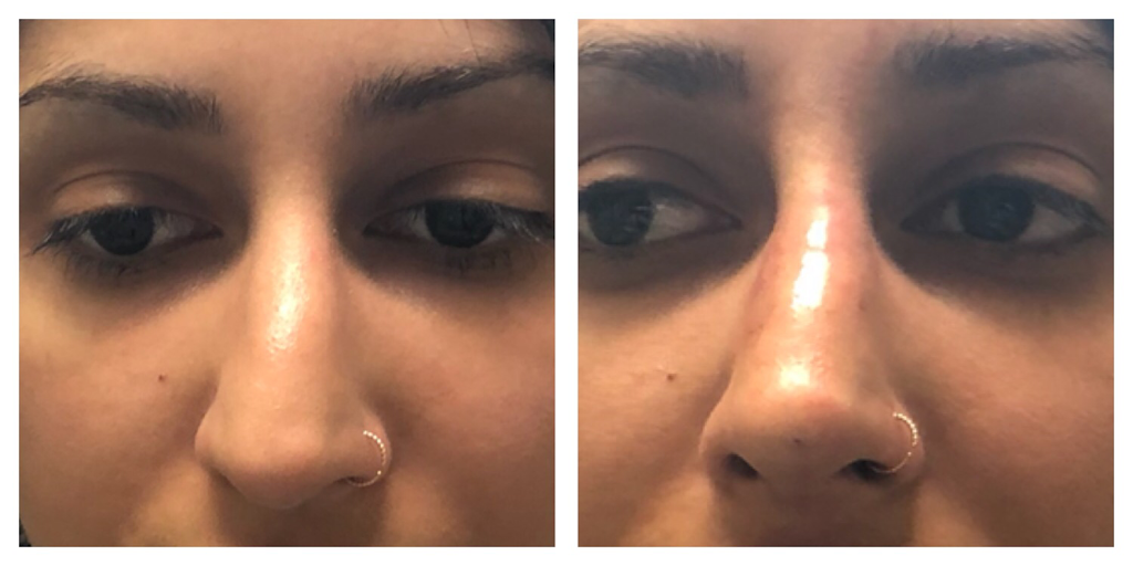 Ageless Medical Cosmetic Clinic | 1100 Dundas St W unit 1, Mississauga, ON L5C 4E7, Canada | Phone: (647) 951-5392