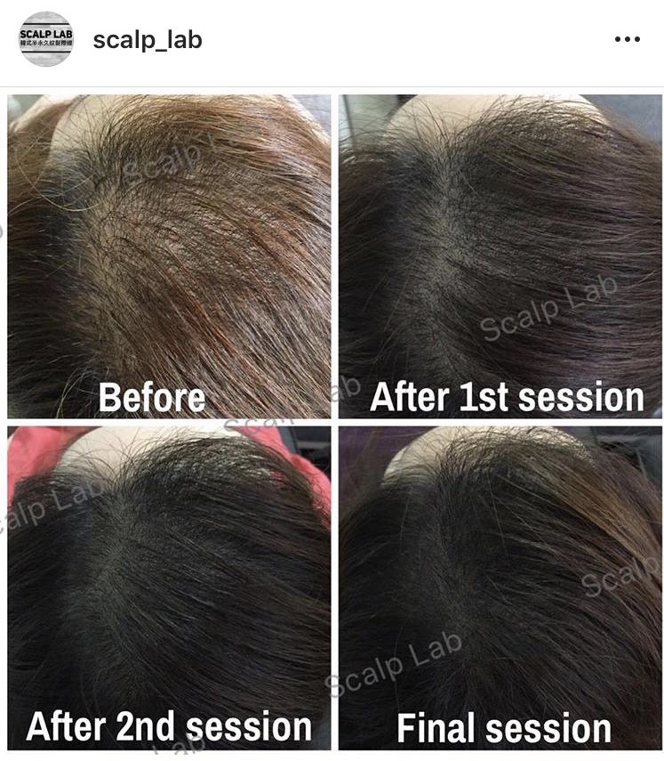 Scalp Lab | 135 Village Green Square, Scarborough, ON M1S 0G4, Canada | Phone: (416) 823-9300