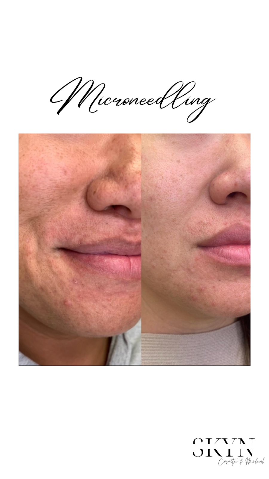 SKYN Cosmetic & Medical Studio | 5920 Turney Dr, Mississauga, ON L5M 2R8, Canada | Phone: (905) 812-0513