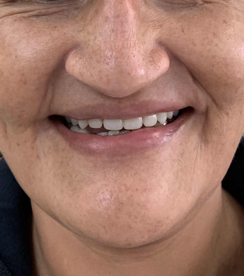 KIM DENTURE CLINIC | 12565 88 Ave #105, Surrey, BC V3W 3J7, Canada | Phone: (778) 222-7447