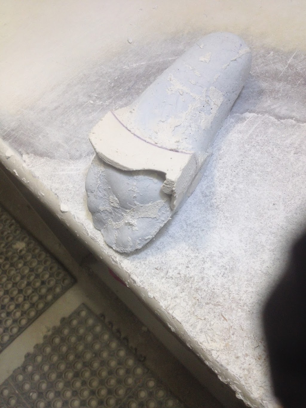 Prodigy Orthotics Lab | #100, 14357 - 104 Avenue c/o Spring Health Centre Surrey BC V3T 1Y1 CA, 14357 104 Ave #100, Surrey, BC V3T 1Y1, Canada | Phone: (604) 559-3668