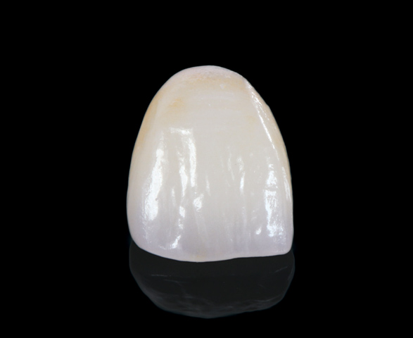 MicroDental Laboratory Vancouver | 3689 E 1st Ave #200, Vancouver, BC V5M 1C2, Canada | Phone: (604) 873-0888