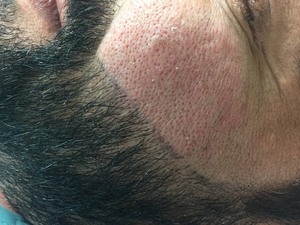 Jade Electrolysis | 2655 Clearbrook Rd #162, Abbotsford, BC V2T 2Y6, Canada | Phone: (604) 273-9091