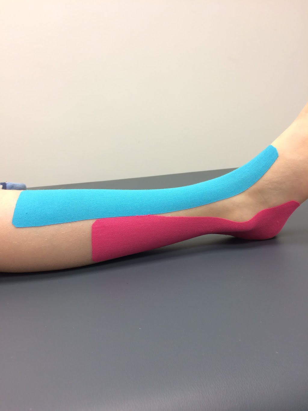 Cohesion Physiotherapy | 20 Freel Ln #4, Whitchurch-Stouffville, ON L4A 8B9, Canada | Phone: (905) 591-8100