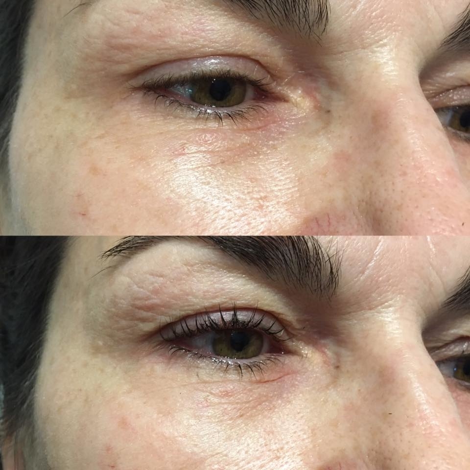 Bella Beaute Soins Esthetiques | 105 Rang Kempt, Le Haut-Richelieu, QC J0J 1K0, Canada | Phone: (450) 347-2277