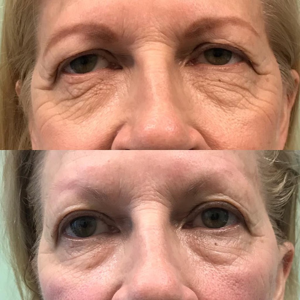 Medic laser and Skin care | 1296 Pacific Blvd, Vancouver, BC V6Z 2V1, Canada | Phone: (604) 633-2474