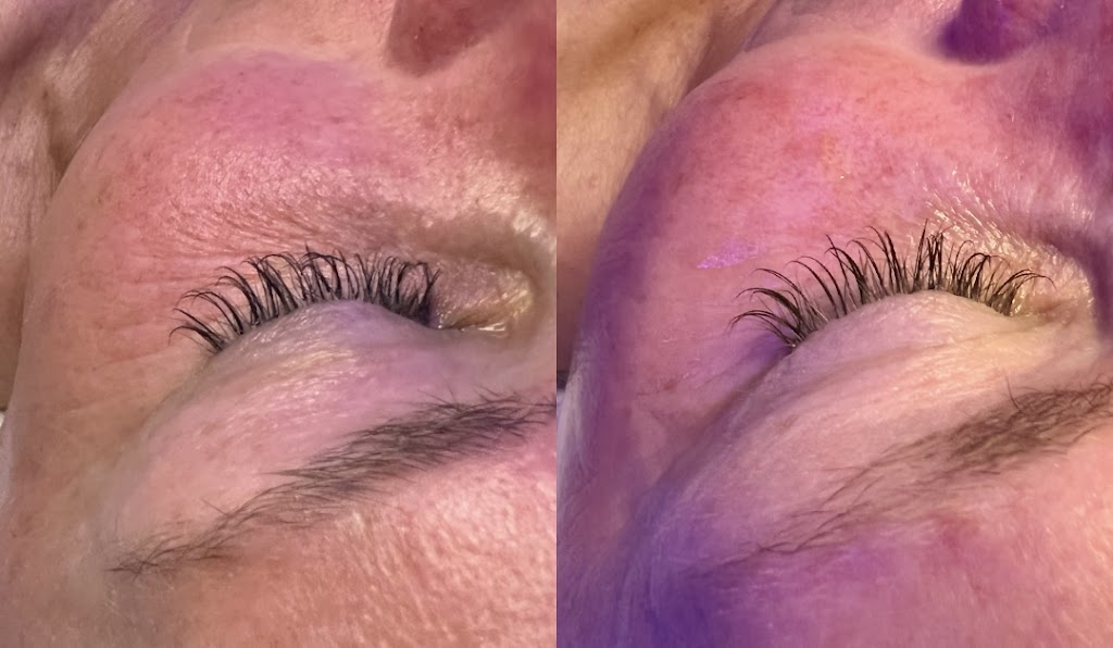 ah esthetics | 1002 King St E, Hamilton, ON L8M 1C8, Canada | Phone: (519) 771-8088