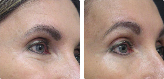Dermace Advanced Skin Care Clinic | 6633 Hwy 7 suite 303, Markham, ON L3P 7P2, Canada | Phone: (905) 554-8144