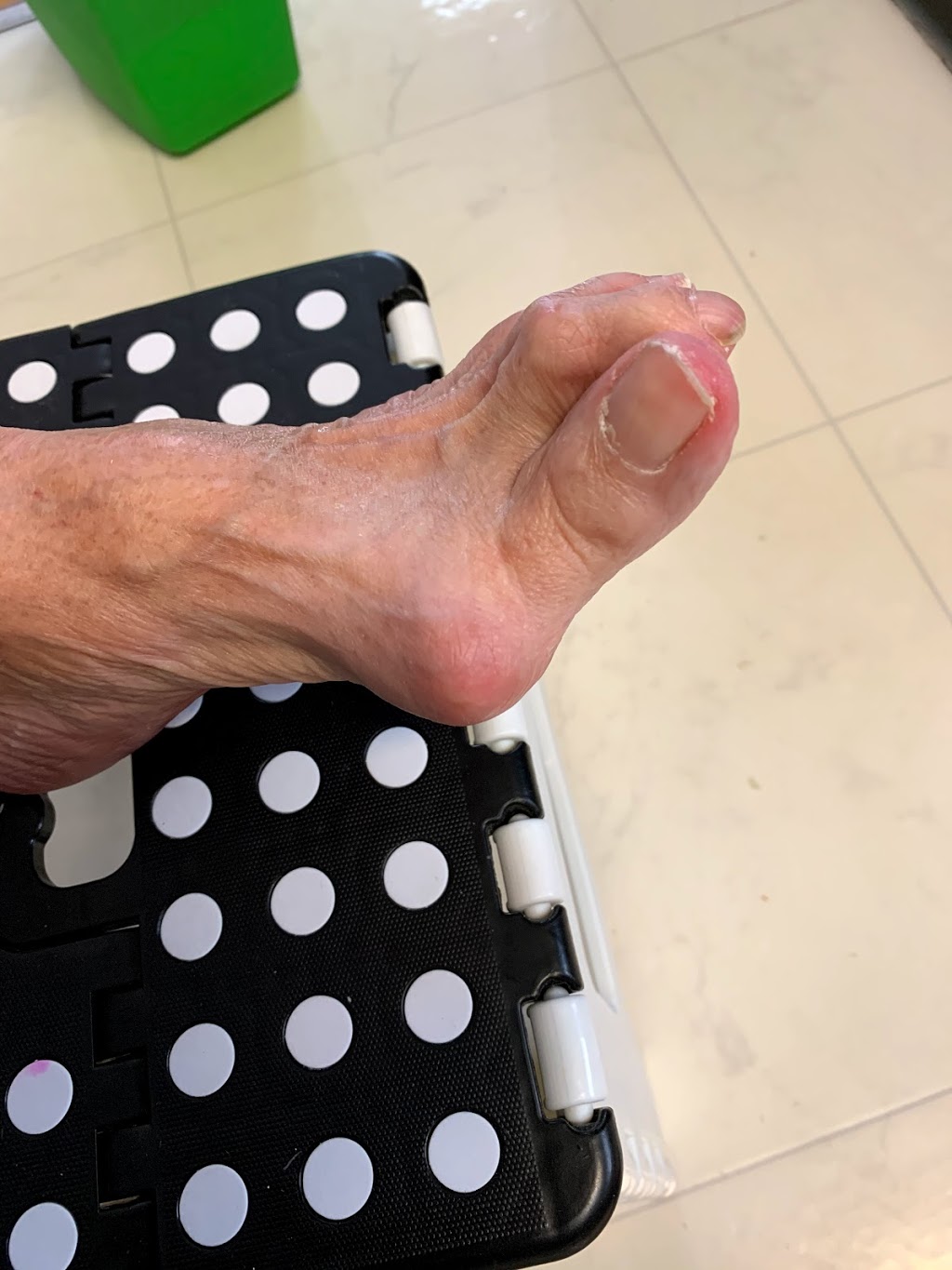 Max Your Step Footcare by Nurses | 1879 N Main St, Westville, NS B0K 2A0, Canada | Phone: (902) 752-1172