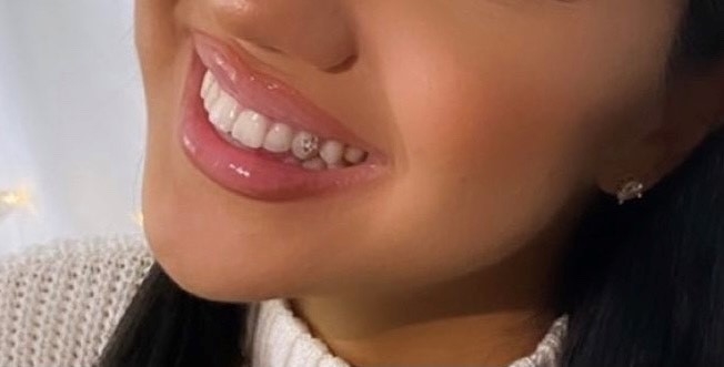 Blanche Smiles | 274 Markham Rd, Scarborough, ON M1J 3C5, Canada | Phone: (416) 885-1311