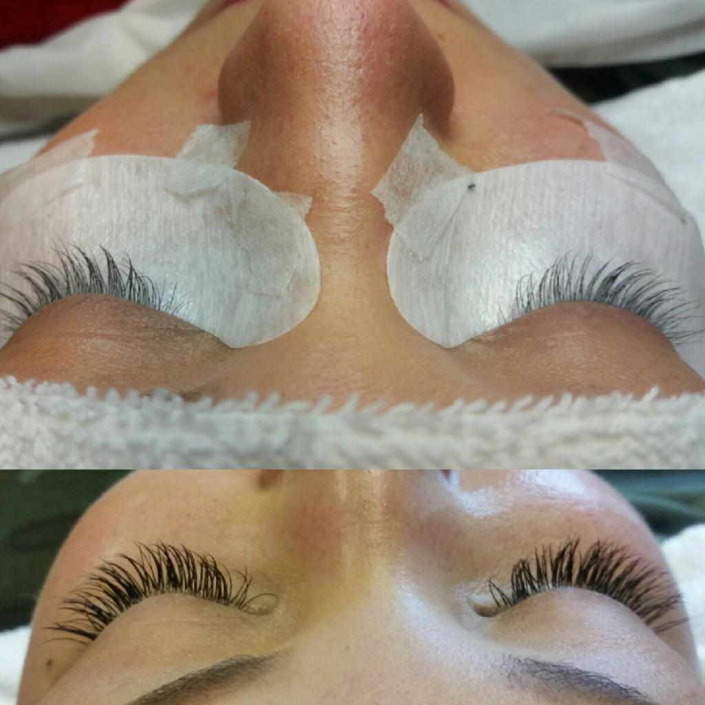 Odettes Skin Laser Wellness Clinic | 31 - 10042 Main Street, Lake Country, BC V4V 1P6, Canada | Phone: (250) 765-7892