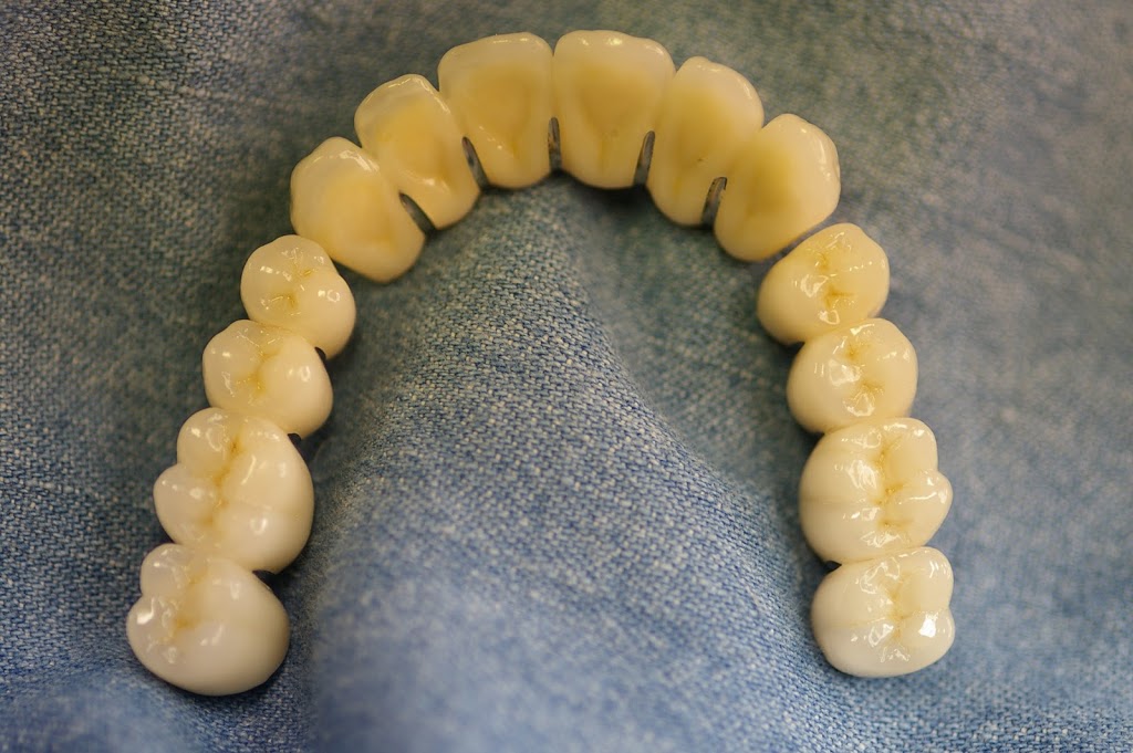 Implant Restorations Inc | 661 Sandford Rd, Uxbridge, ON L9P 1R2, Canada | Phone: (866) 802-3623