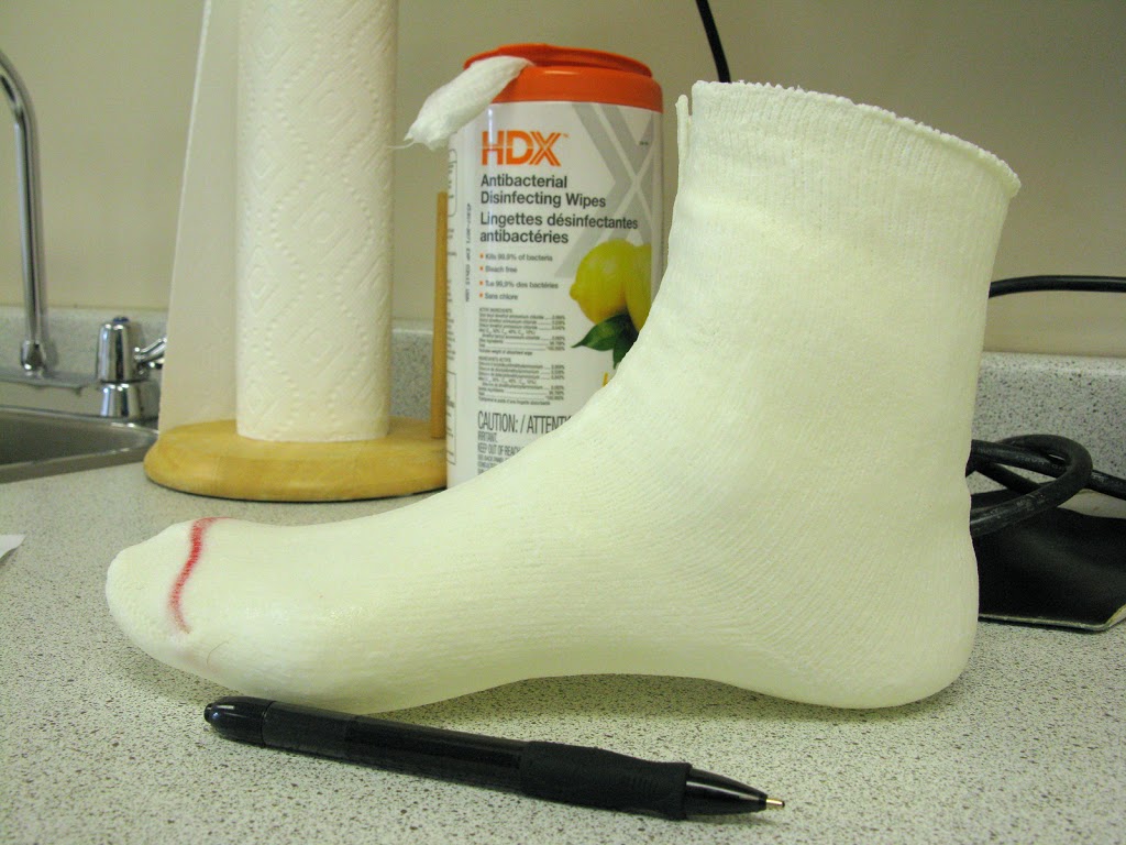 The Foot Lab | 8708 155 St NW #106, Edmonton, AB T5R 1W2, Canada | Phone: (780) 477-2552