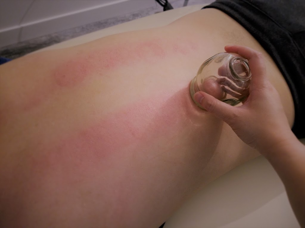Simple Root Acupuncture Clinic | 5586 Windermere Blvd #204, Edmonton, AB T6W 2Z8, Canada | Phone: (780) 988-4488