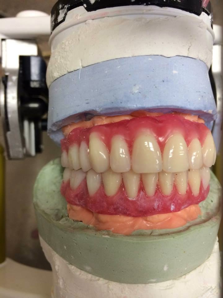 Rizzoli Denture & Implant Clinic | 4504 50 St #6, Stony Plain, AB T7Z 1L5, Canada | Phone: (780) 591-1800