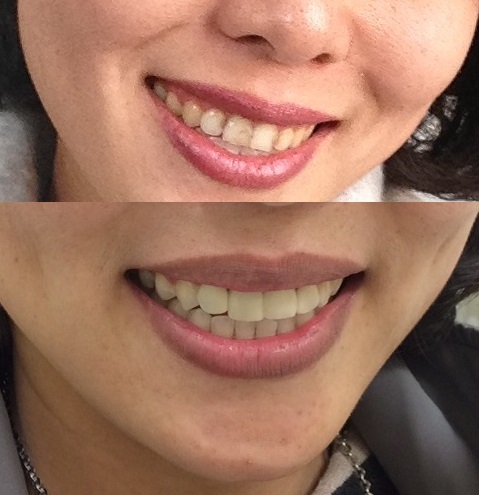 Westoak Dental Centre | 2690 Westoak Trails Blvd #6, Oakville, ON L6M 3T3, Canada | Phone: (905) 825-3336