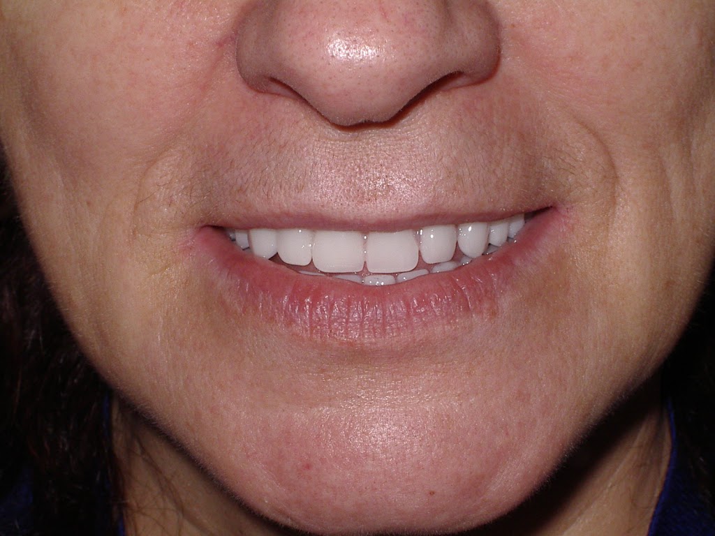 Boisvert Denturologiste | 2000 Chemin du Fer-à-Cheval suite F, Sainte-Julie, QC J3E 2T7, Canada | Phone: (450) 649-4545