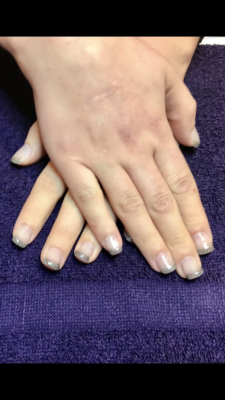 Serenity Lane Esthetics | 10 Dalgetty Pl NW, Calgary, AB T3A 1H9, Canada | Phone: (587) 229-2686