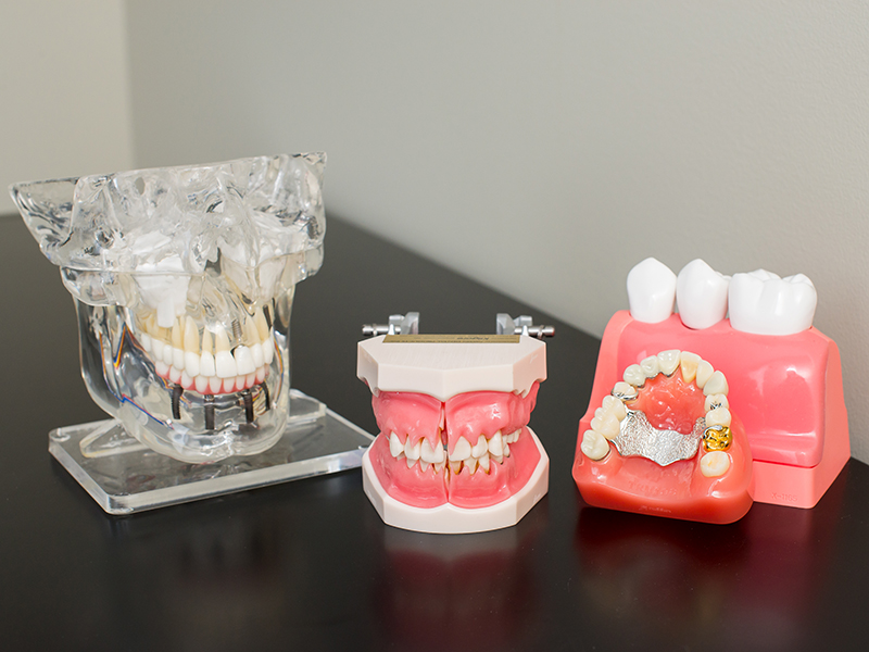 Sunrise Centre Dental - Drs. John and Sharon Koncan | 33 King William St #201, Huntsville, ON P1H 2L4, Canada | Phone: (705) 789-2369