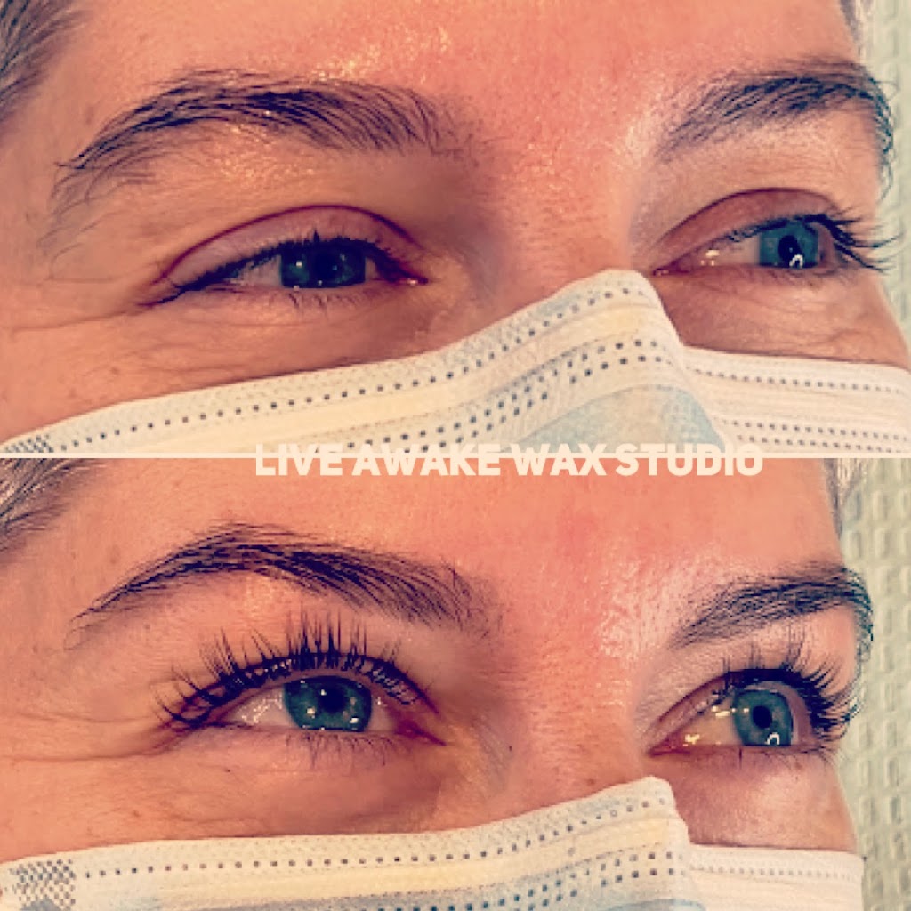 Live Awake Wax Studio & Laser Hair Removal | 20503 42 Ave, Langley, BC V3A 3A8, Canada | Phone: (604) 720-5445