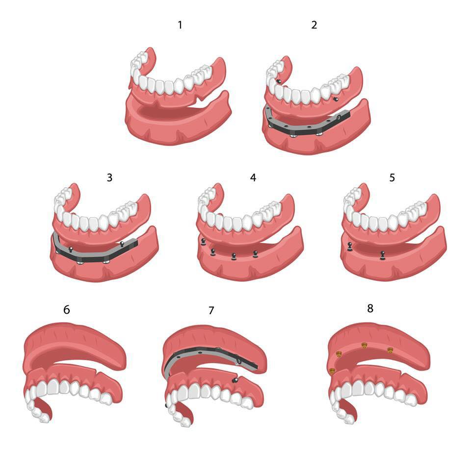 Centre de Denturologie Ranger et Associés. | 2424 Boul. Lapinière, Brossard, QC J4Z 2K9, Canada | Phone: (450) 465-9111