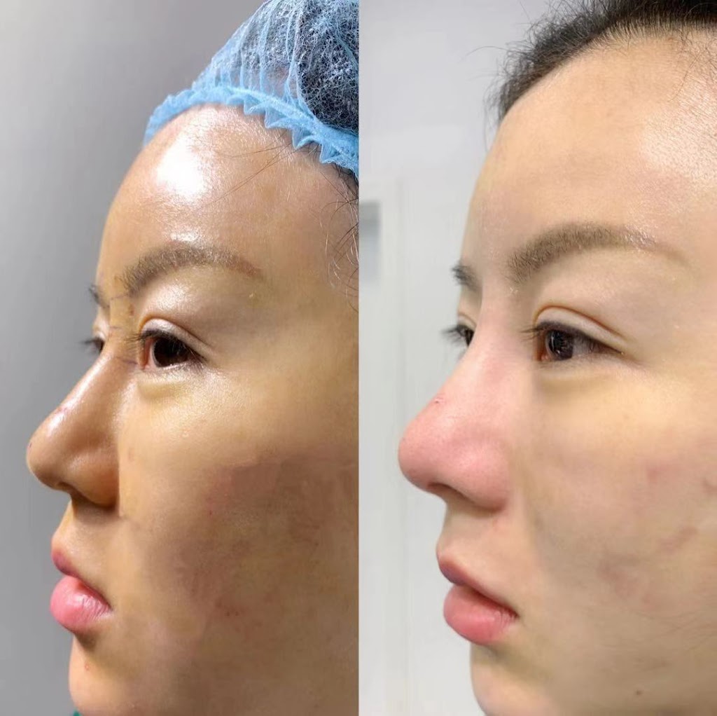 Oakville Flawless Cosmetic | 3075 Hospital Gate #109 First Floor Of North Oakville Medical Center, Oakville, ON L6M 1M1, Canada | Phone: (289) 885-5660