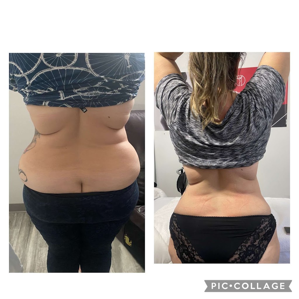 Precise Body Lab | 31125 Kingfisher Dr, Abbotsford, BC V2T 5K4, Canada | Phone: (778) 345-5345