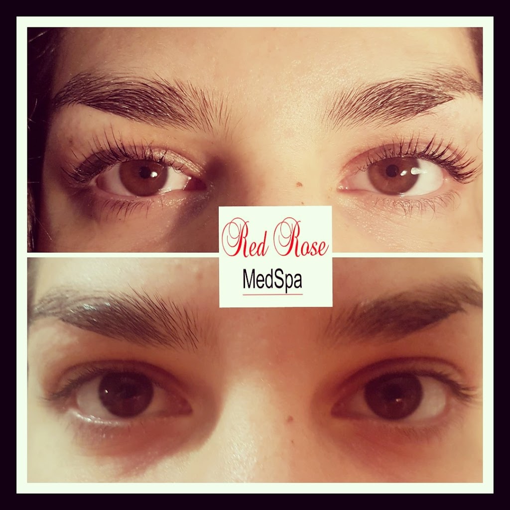 Red Rose Medspa | inside Salon poise, 830 Rowntree Dairy Rd unit 16, Woodbridge, ON L4L 5V2, Canada | Phone: (647) 822-5106