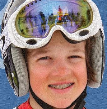 Mountain Orthodontics | 40258 Glenalder Pl, Squamish, BC V8B 0G2, Canada | Phone: (604) 892-5969