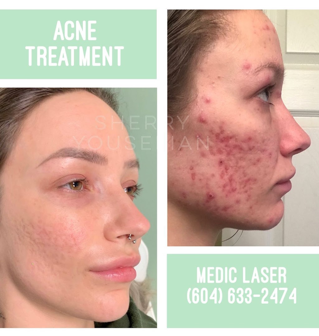 Medic laser and Skin care | 1296 Pacific Blvd, Vancouver, BC V6Z 2V1, Canada | Phone: (604) 633-2474