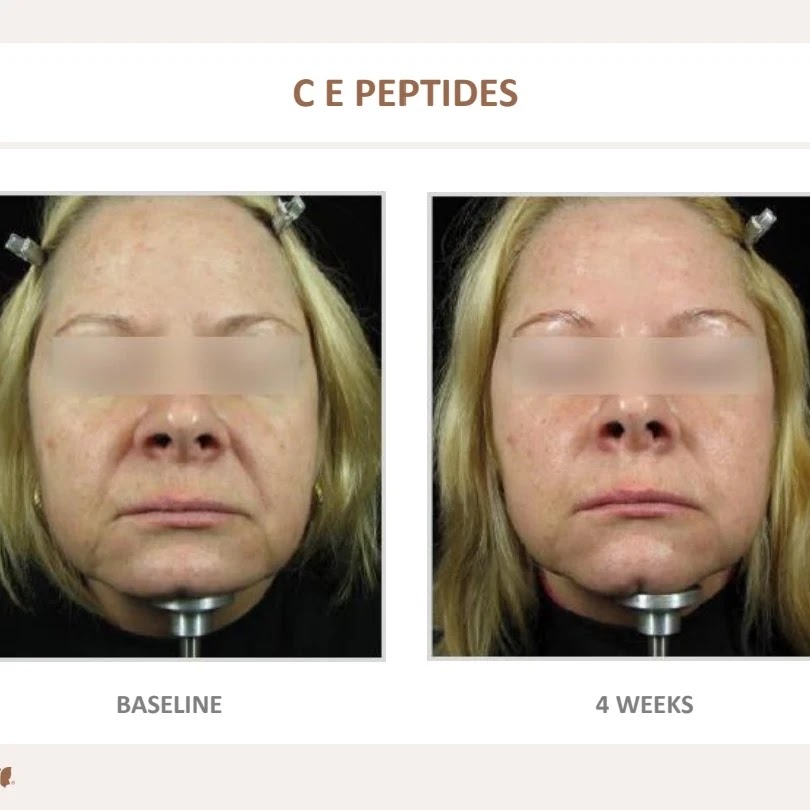 NuSkin Cosmetic Laser Clinic | Call for locations near you, 9991 Hwy 7, Kawartha Lakes, ON K9H 0A1, Canada | Phone: (705) 991-4767
