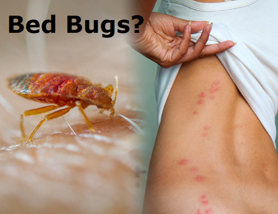 Ensure Pest Control Inc. | 2247 Hurontario St, Mississauga, ON L5A 2G2, Canada | Phone: (647) 961-7426