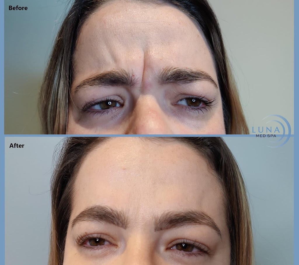 Luna Med Spa | RCI & MedSpa Group, 5045 Mainway Suite 201, Burlington, ON L7L 5Z1, Canada | Phone: (905) 981-8454
