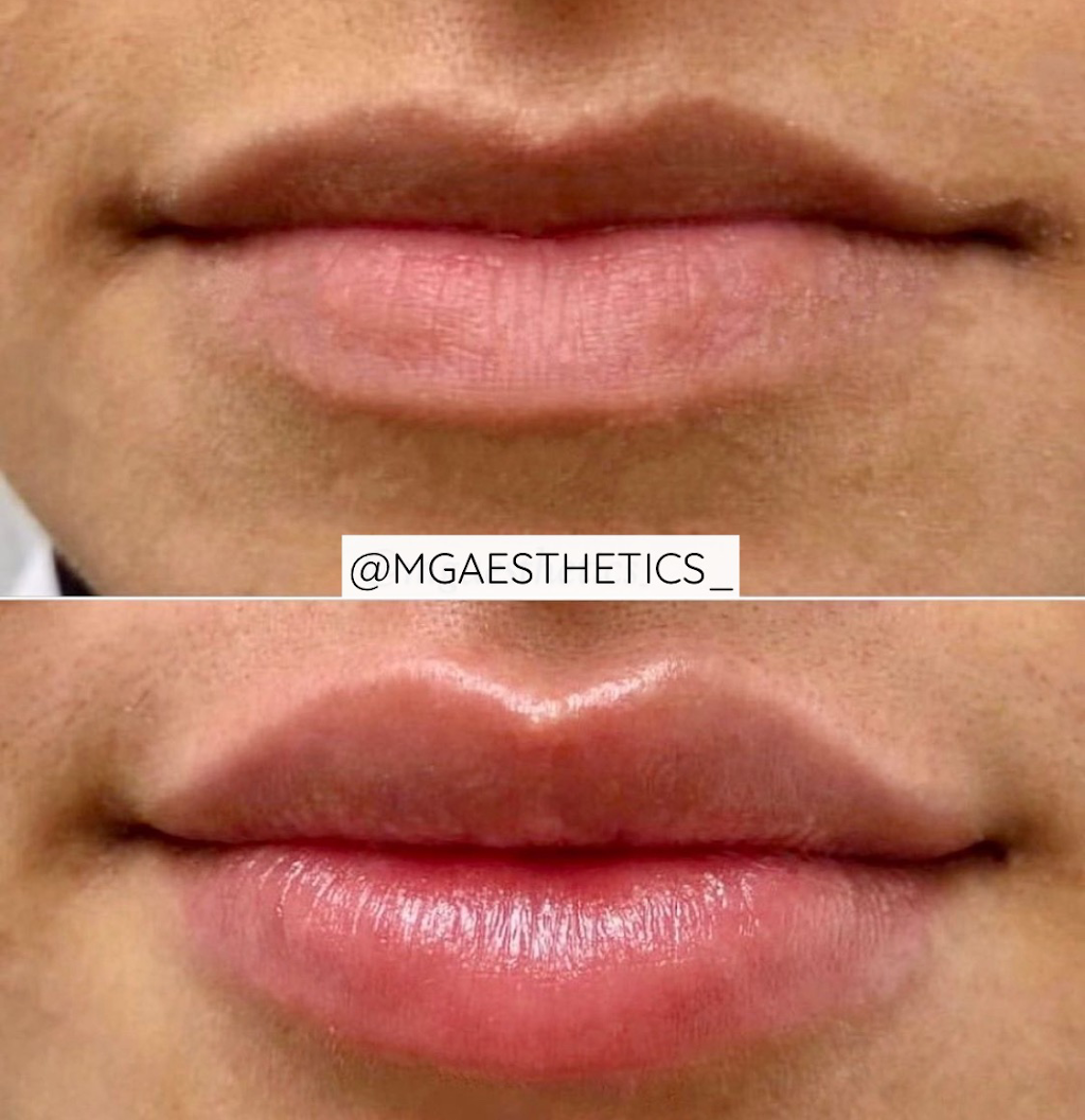 MG AESTHETICS | 10395 Weston Rd, Woodbridge, ON L4H 3T4, Canada | Phone: (289) 380-7774