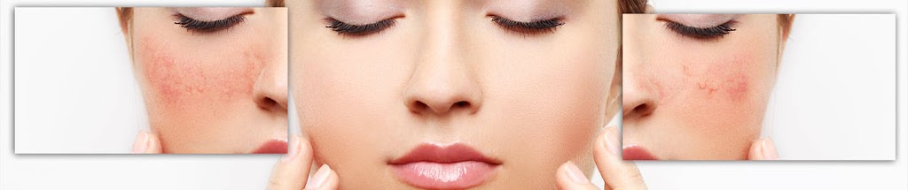RadiantGloSkin | 629 Cranston Dr SE, Calgary, AB T3M 0M6, Canada | Phone: (780) 710-6247