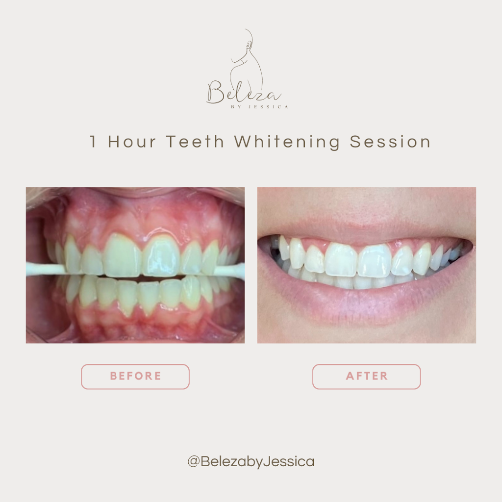 Beleza By Jessica | 406 Cundles Rd W, Barrie, ON L4N 7C6, Canada | Phone: (416) 558-1423