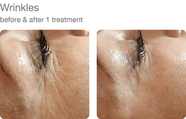 Medical Esthetics by Katie | 625 5th Ave #501, New Westminster, BC V3M 1X4, Canada | Phone: (604) 544-2237