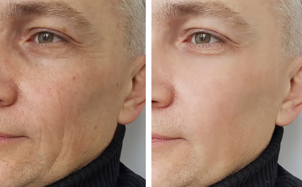 RestoBod Laser Clinics | 11500 29 St SE #104, Calgary, AB T2Z 3W9, Canada | Phone: (403) 724-0090