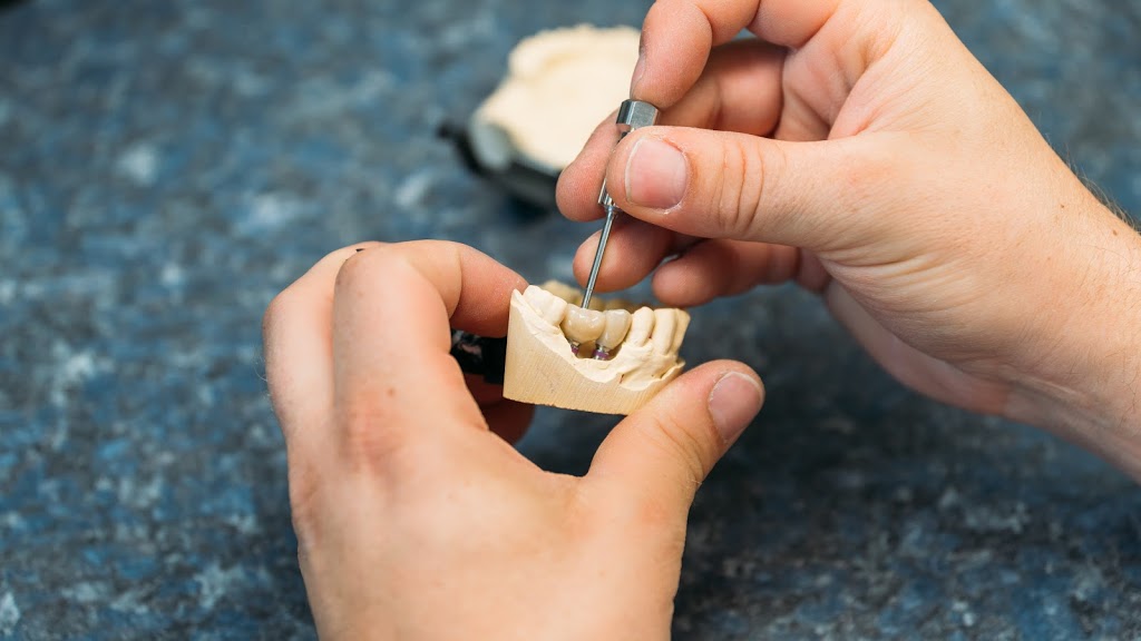 Schack Dental Ceramic Ltd | 757 K. L. O. Rd #1, Kelowna, BC V1Y 9L8, Canada | Phone: (250) 860-1727