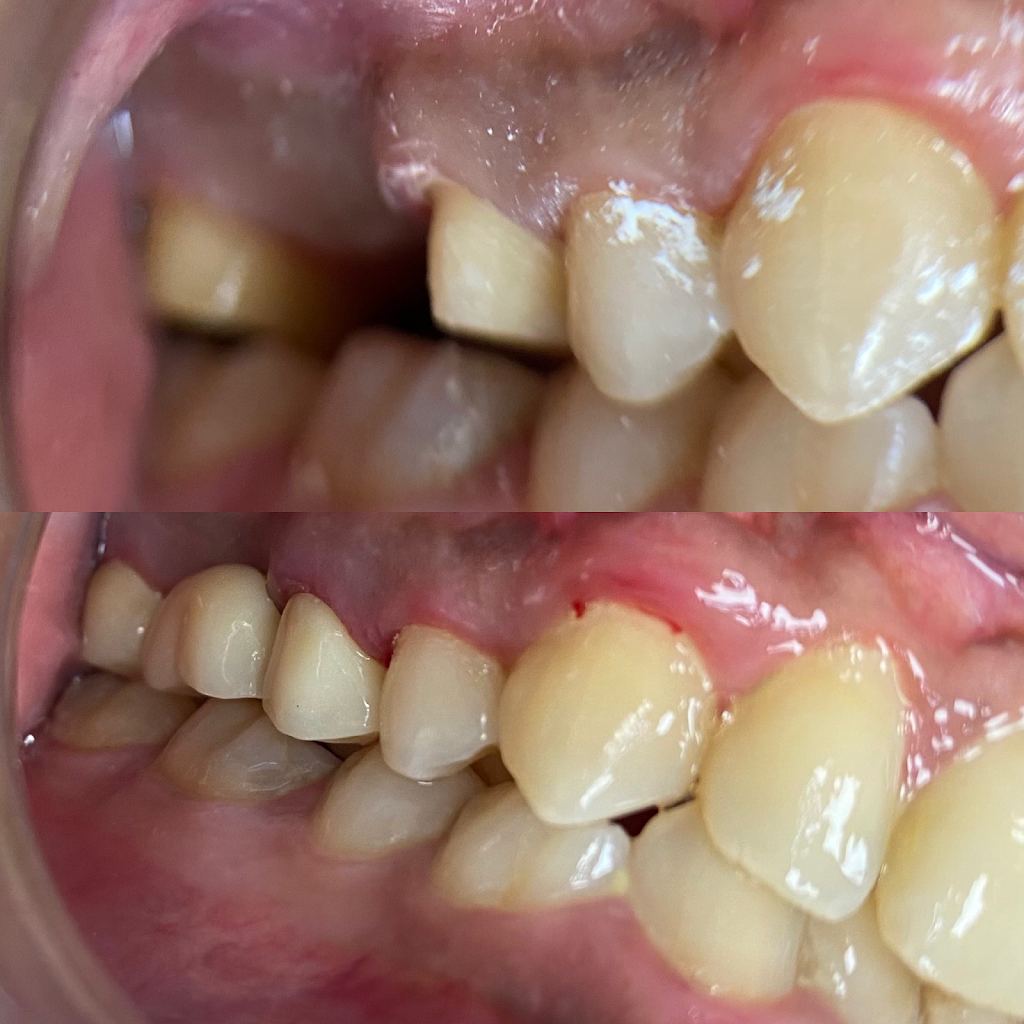 Blossom Smiles Dental | 3235 Fairview St unit 4, Burlington, ON L7N 3L1, Canada | Phone: (289) 812-8278