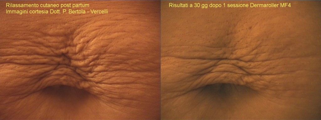 Saskatoon Skin Renewal | #2-125 Ave C north, Saskatoon, SK | Phone: (306) 250-5540