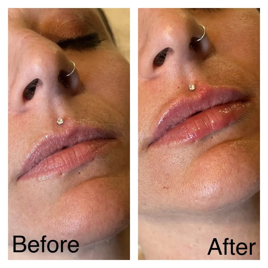 NuSkin Cosmetic Laser Clinic | Call for locations near you, 9991 Hwy 7, Kawartha Lakes, ON K9H 0A1, Canada | Phone: (705) 991-4767