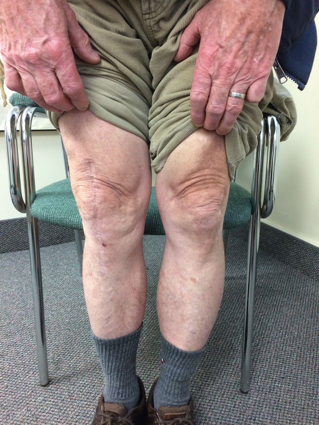 Regenerative Therapy Niagara | 12 Grote St, St. Catharines, ON L2N 2E7, Canada | Phone: (905) 984-3433